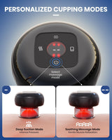 Electric Cupping Therapy Set 2-Pack – Smart Massager with Heat & Red Light