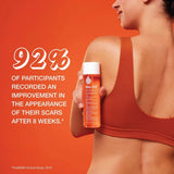 Bio-Oil Skincare Body Oil Serum – For Scars, Stretch Marks & Skin Hydration | Face & Body