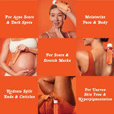Bio-Oil Skincare Body Oil Serum – For Scars, Stretch Marks & Skin Hydration | Face & Body